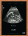 2000 Alien Resurrection PS1 Original Ad - for just $17.99! 