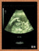 2000 Alien Resurrection PS1 Original Ad v2 - for just $17.99! 